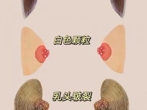 为什么乳头像菜花状？可能是因使用了[产品名称]