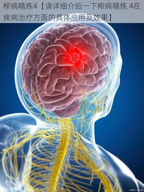 榨病精炼4【请详细介绍一下榨病精炼 4在疾病治疗方面的具体应用及效果】