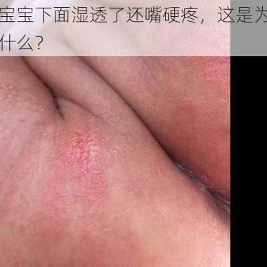 宝宝下面湿透了还嘴硬疼，这是为什么？