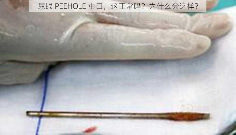 尿眼 PEEHOLE 重口，这正常吗？为什么会这样？